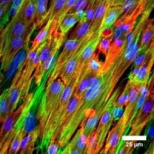 cardiomyocytes.