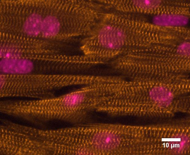 Micropatterned mouse ventricular muscle cells assembled into an anisotropic tissue showing nuclei (pink) and organized sarcomeres (orange).