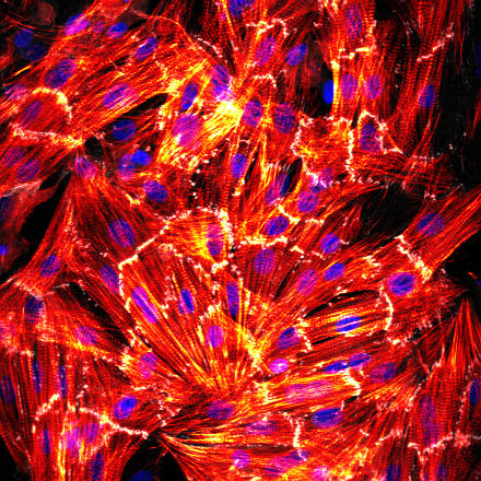 Isotropic cardiac myocyte monolayer stained for actin (red), beta-catenin (white), and nuclear DNA (blue).
