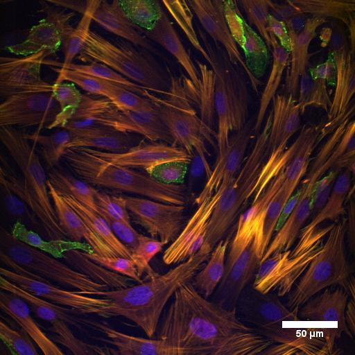 Valve endothelial cells (VECs) interspersed within an isotropic monolayer of valve interstitial cells (VICs)