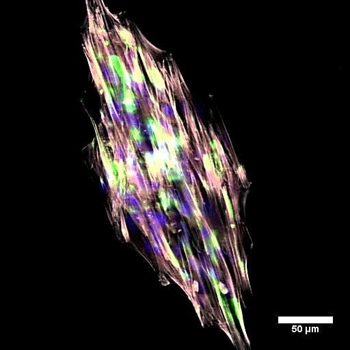 aligned diamond tissue composed of porcine valve interstitial cells.