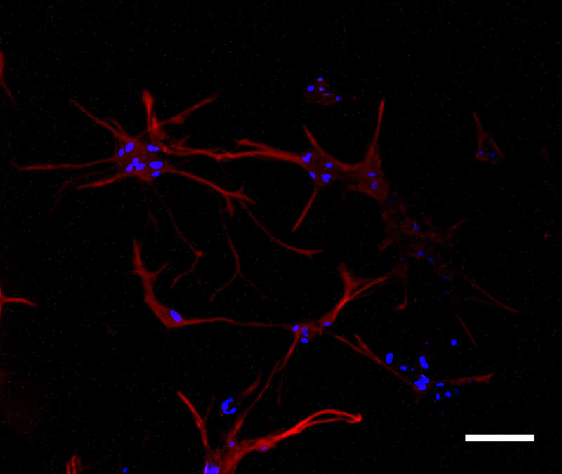 Purified primary harvest astrocytes from neonatal sprague-dawley rat stained for GFAP, astrocyte (red), Nuclear DNA (blue). Scale bar= 50um.