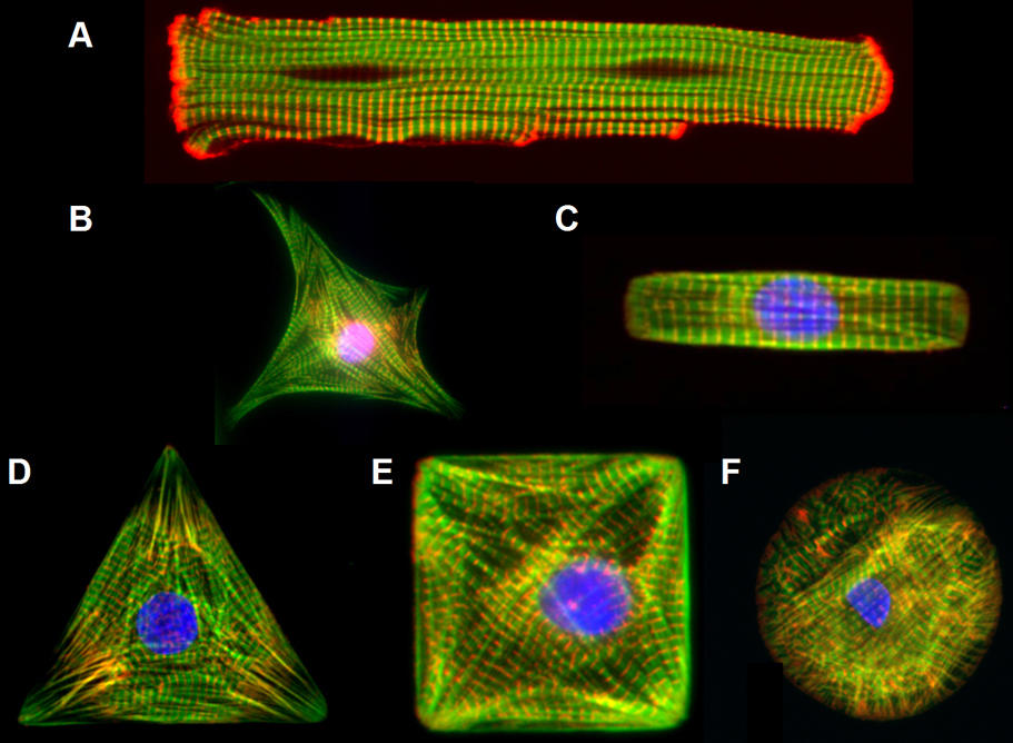 img-research-myocyteshapes.jpg